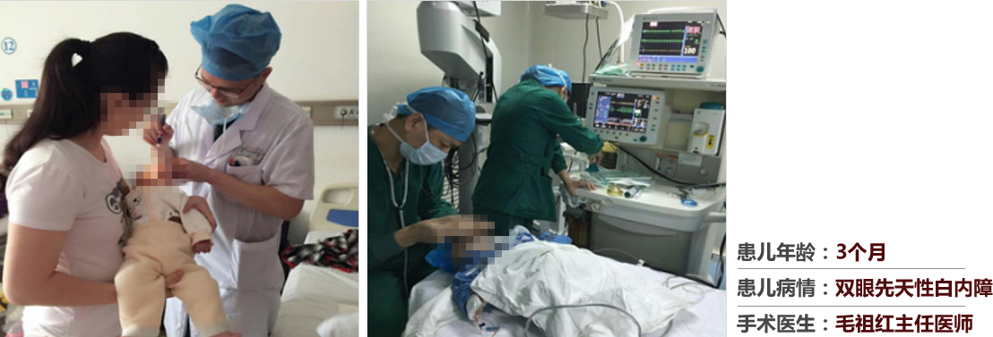 患兒年齡：3個月，患兒病情：雙眼先天性白內障，手術醫(yī)生：毛祖紅主任醫(yī)師