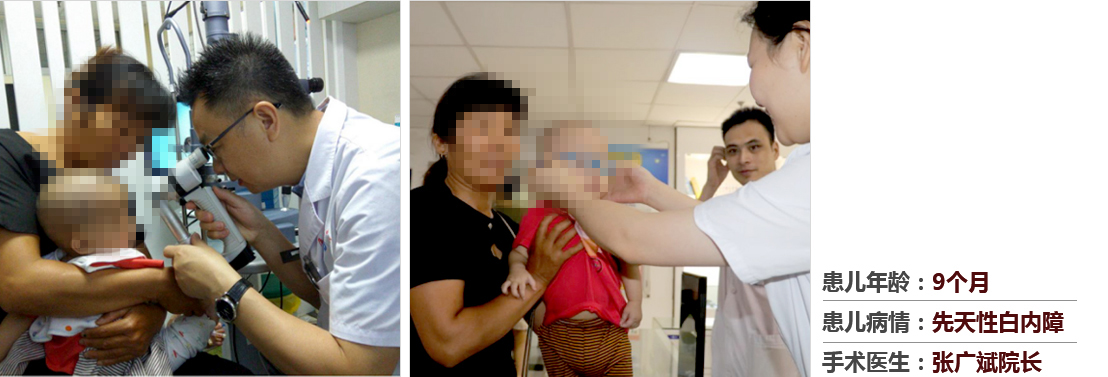 患兒年齡：9個月，患兒病情：先天性白內障，手術醫(yī)生：張廣斌院長