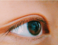 倒睫是由什么原因引起的？